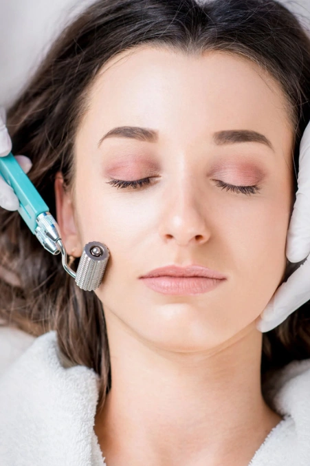 woman undergoing a derma roller treatment improves her skin's appearance and promotes rejuvenation.