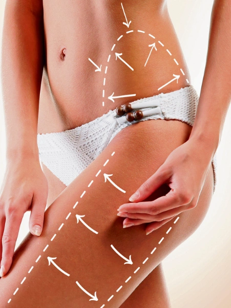 Top Thigh Fat Removal Treatments Surgery in Borivali, Mumbai Top Thigh Fat Removal Treatments Surgery in Borivali, Mumbai